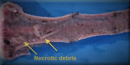 infectious laryngotracheitis necrotic debris in trachea