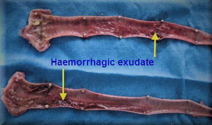 infectious laryngotracheitis haemorrhagic exudate in trachea