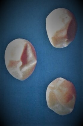 deformed egg shells- infectious bronchitis